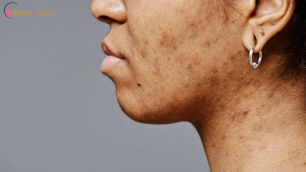 Can You Slow Down Melanin Production? 
