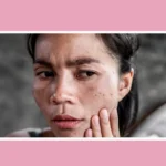 How to Reduce Melanin in Skin: Safe and Effective Methods