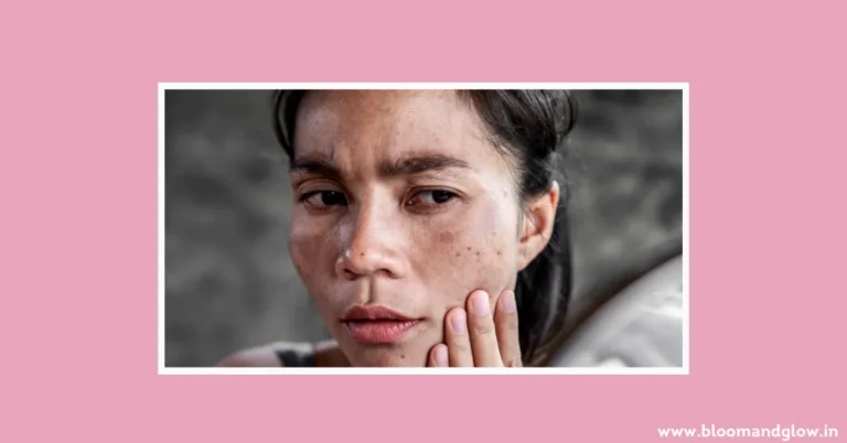 How to Reduce Melanin in Skin: Safe and Effective Methods