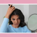 How to Prevent Dandruff During Winter: Simple Tips for Flake-Free Hair