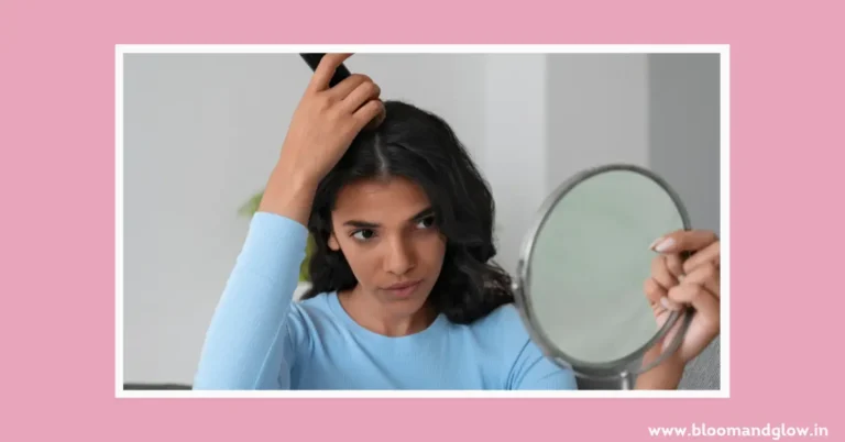 How to Prevent Dandruff During Winter: Simple Tips for Flake-Free Hair